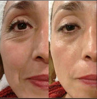 Roveo GlowLift Pro