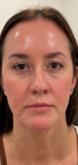 Arya, 32